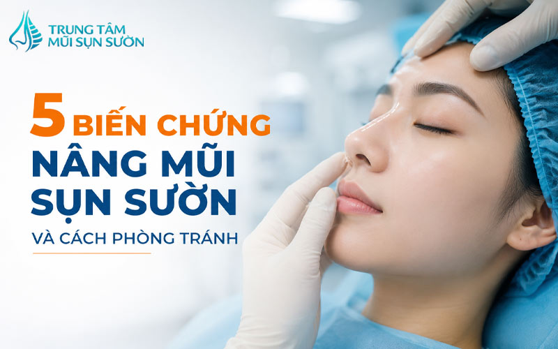 bien-chung-nang-mui-sun-suon