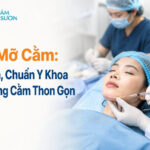 Cấy mỡ cằm