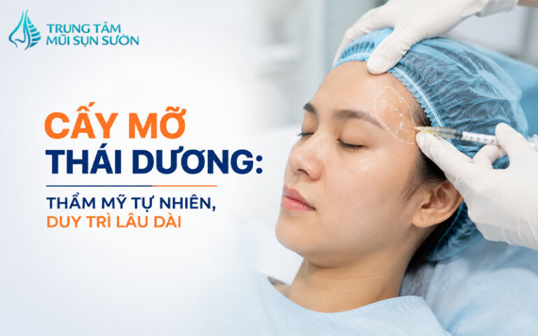 Cấy mỡ thái dương