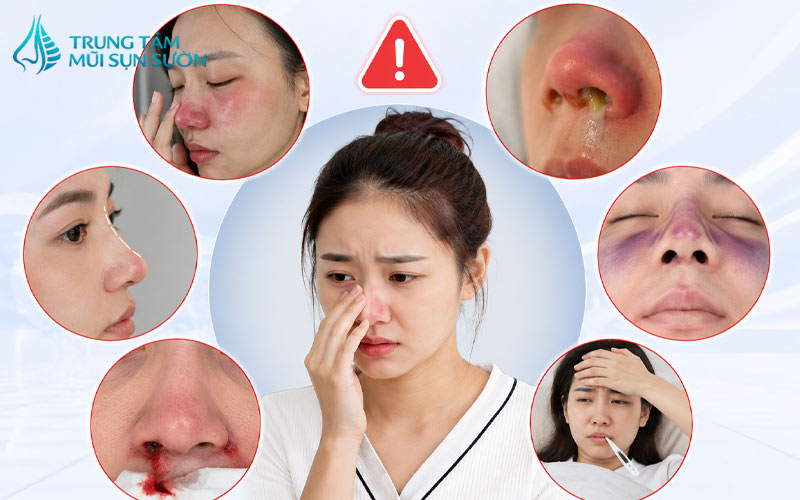 dau-hieu-canh-bao-bien-chung-can-tham-kham-ngay