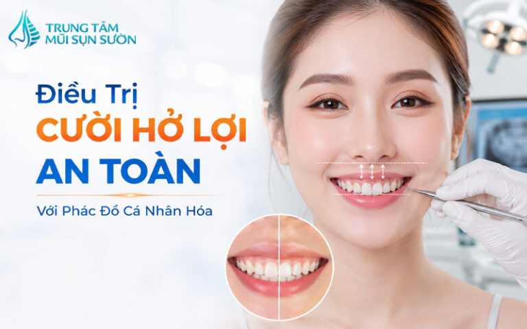 Điều trị cười hở lợi