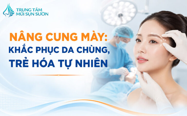 Nâng cung mày