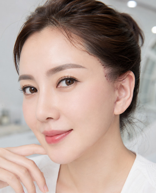 Phẫu thuật căng da mặt bán phần