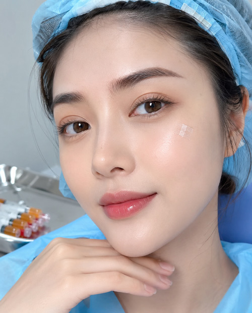 Phẫu thuật cấy mỡ làm đầy vùng mặt