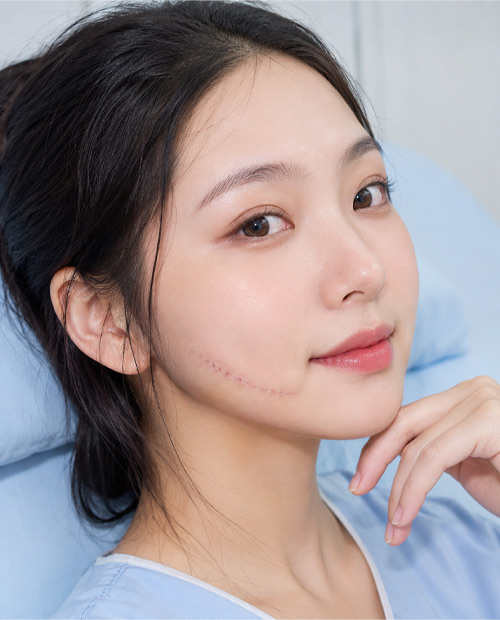 Phẫu thuật vết thương phần mềm vùng hàm mặt không thiếu hổng tổ chức
