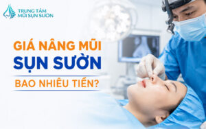 Giá nâng mũi sụn sườn bao nhiêu tiền? Cập nhật mới 2026