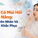 Mũi có mùi hôi sau nâng: Nguyên nhân và cách khắc phục