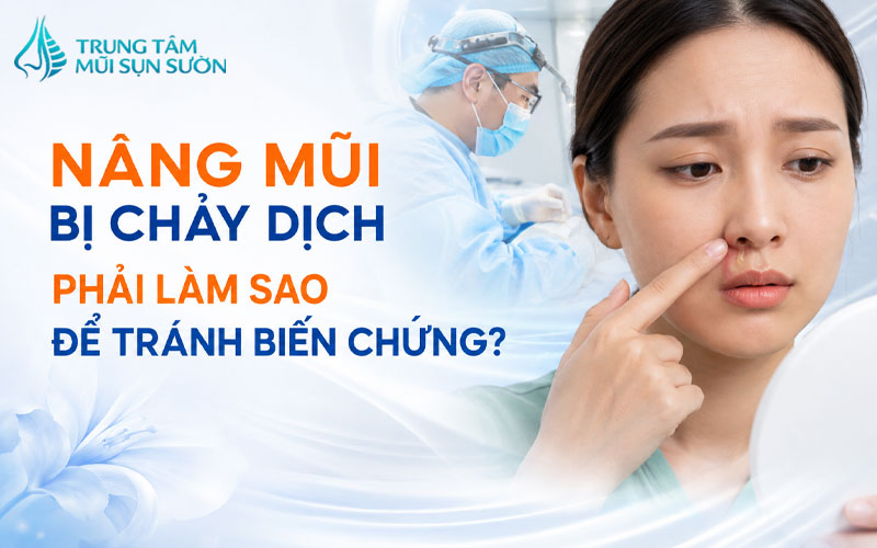 nang-mui-bi-chay-dich