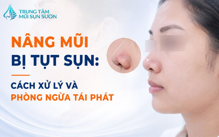 Nâng mũi bị tụt sụn: Cách xử lý và phòng ngừa tái phát