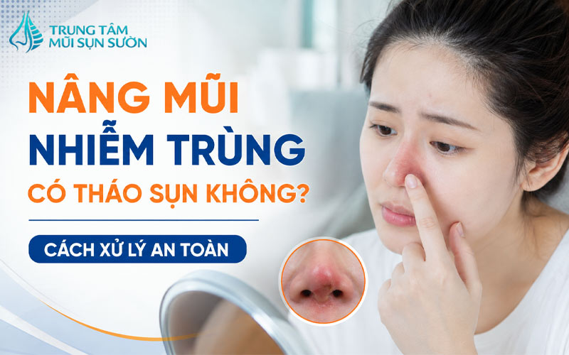 nang-mui-nhiem-trung-co-thao-sun-khong