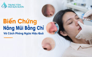 Biến chứng nâng mũi bằng chỉ và cách phòng ngừa hiệu quả