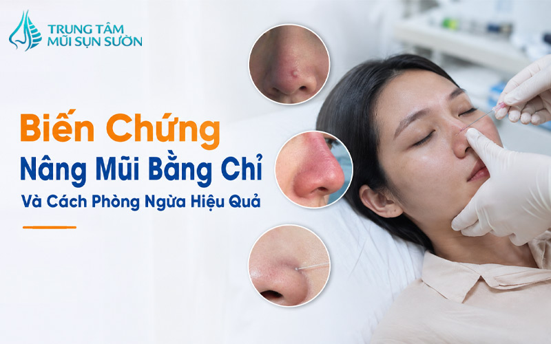 bien-chung-nang-mui-bang-chi