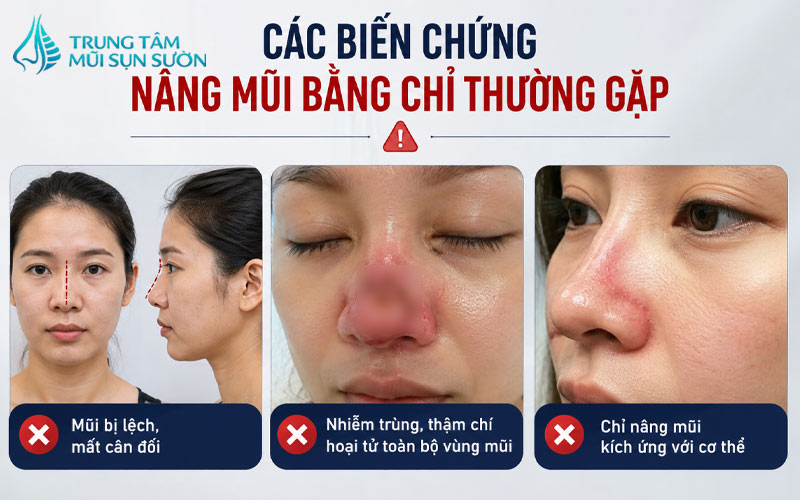 cac-bien-chung-nang-mui-bang-chi-thuong-gap