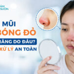 Đầu mũi bị bóng đỏ sau nâng do đâu? Cách xử lý an toàn