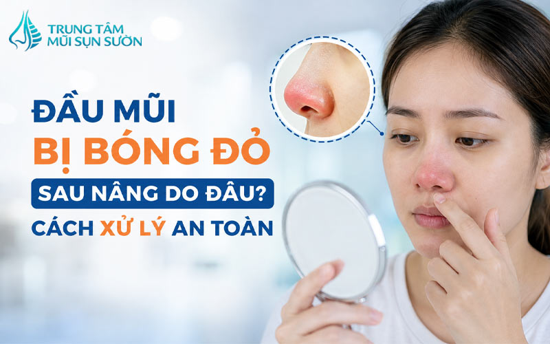 dau-mui-bi-bong-do-sau-nang