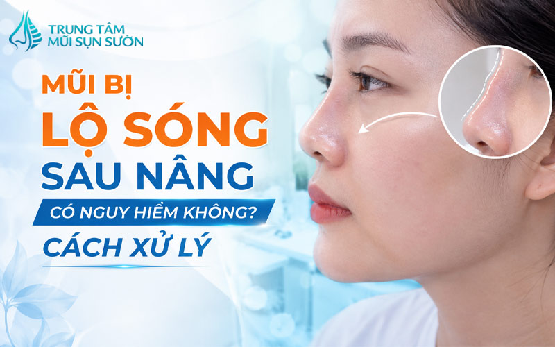 mui-bi-lo-song-sau-nang