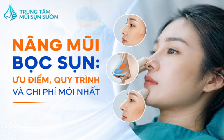 Nâng mũi bọc sụn: Ưu điểm, quy trình và chi phí mới nhất