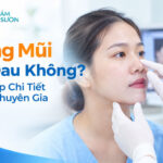 Nâng mũi có đau không? Giải đáp chi tiết từ A đến Z