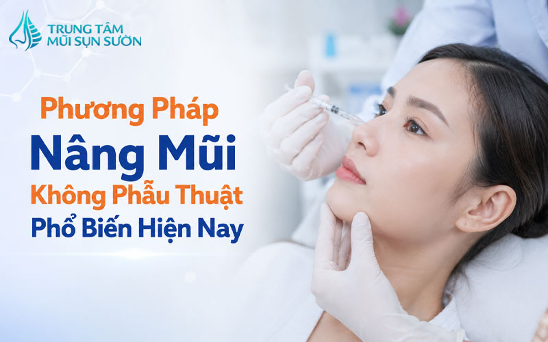 nang-mui-khong-phau-thuat