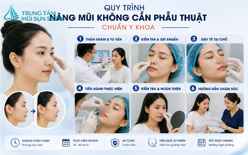 quy-trinh-nang-mui-khong-can-phau-thuat-chuan-y-khoa